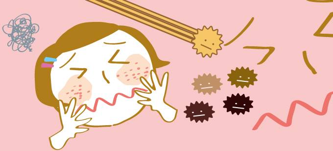 シミのできる仕組み